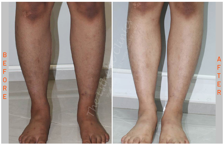 Esthetic Body Brite 